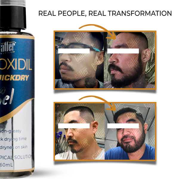 Gaffer 10% Quick dry Minoxidil GEL